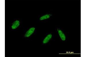 Immunofluorescence (IF) image for anti-Zinc Finger, MYND-Type Containing 11 (ZMYND11) (AA 1-508) antibody (ABIN2566057)