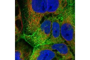 Immunofluorescent staining of CACO-2 with VIL1 polyclonal antibody  (Green) shows positivity in plasma membrane and nucleus but excluded from the nucleoli. (Villin 1 抗体)