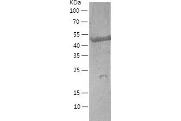 FKBP5 Protein (AA 1-457) (His tag)