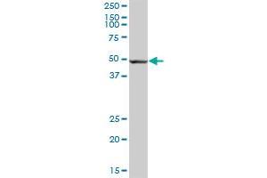 ALDH3A2 MaxPab polyclonal antibody. (ALDH3A2 抗体  (AA 1-508))