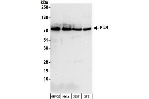 Western Blotting (WB) image for anti-Fused in Sarcoma (FUS) (AA 1-50) antibody (ABIN7454607) (FUS 抗体  (AA 1-50))