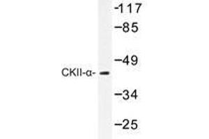 Western blot analysis of CKII-α antibody in extracts from HeLa cells. (CSNK2A1/CK II alpha 抗体)
