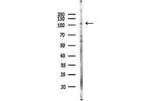anti-Adducin 2 (Beta) (ADD2) (Internal Region) antibody