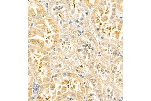 Immunohistochemistry of paraffin embedded rat kidney using PTPN2 (ABIN7075295) at dilution of 1:900 (400x lens)
