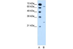 NAT2 antibody used at 2. (NAT2 抗体)