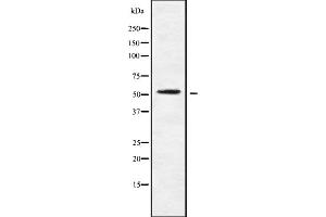 Western blot analysis of mAChR M4 using K562 whole cell lysates (CHRM4 抗体  (Internal Region))