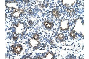 GUSB antibody was used for immunohistochemistry at a concentration of 4-8 ug/ml to stain Alveolar cells (arrows) in Human Lung. (Glucuronidase beta 抗体  (C-Term))