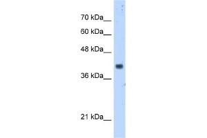 WB Suggested Anti-PDSS1 Antibody Titration:  5. (PDSS1 抗体  (Middle Region))