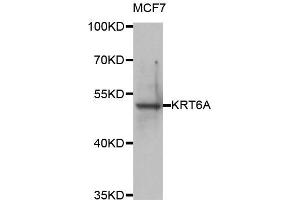 Western blot analysis of extracts of MCF7 cell line, using KRT6A antibody. (KRT6A 抗体)