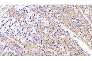 Detection of SLC in Porcine Stomach Tissue using Polyclonal Antibody to Secondary Lymphoid Tissue Chemokine (SLC) (CCL21 抗体  (AA 24-134))