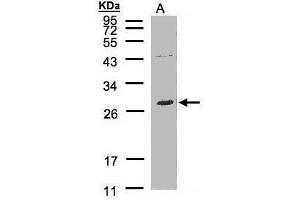 WB Image Sample(30 μg of whole cell lysate) A:Raji, 12% SDS PAGE antibody diluted at 1:500 (LAT2 抗体  (C-Term))