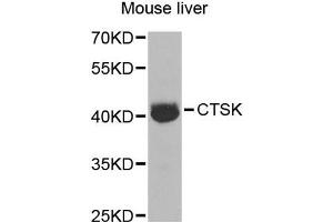 Western blot analysis of extracts of mouse liver, using CTSK antibody (ABIN5970899) at 1/1000 dilution. (Cathepsin K 抗体)