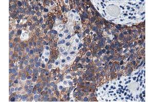 Immunohistochemistry (IHC) image for anti-Aldehyde Dehydrogenase 1 Family, Member L1 (ALDH1L1) antibody (ABIN1496585)