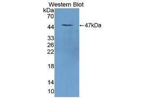 Western blot analysis of the recombinant protein. (REG1A 抗体  (AA 10-165))
