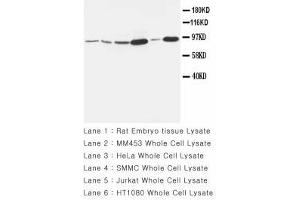 Image no. 1 for anti-Matrix Metallopeptidase 9 (Gelatinase B, 92kDa Gelatinase, 92kDa Type IV Collagenase) (MMP9) (AA 689-705) antibody (ABIN1493479) (MMP 9 抗体  (AA 689-705))