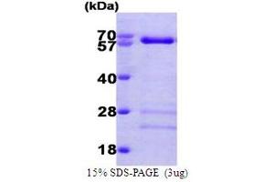 SDS-PAGE (SDS) image for SMAD Family Member 4 (SMAD4) (AA 1-552) protein (His tag) (ABIN666874) (SMAD4 Protein (AA 1-552) (His tag))