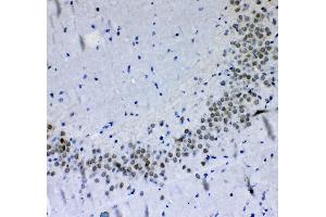 IHC analysis of PER1 using anti-PER1 antibody . (PER1 抗体  (AA 1119-1200))