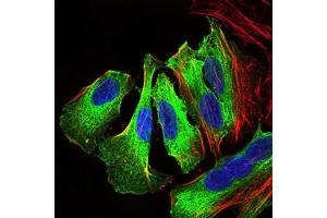Immunocytochemistry (ICC) image for anti-Mitogen-Activated Protein Kinase 14 (MAPK14) (AA 299-360) antibody (ABIN1845584) (MAPK14 抗体  (AA 299-360))