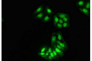 Immunofluorescent analysis of HepG2 cells using ABIN7155291 at dilution of 1:100 and Alexa Fluor 488-congugated AffiniPure Goat Anti-Rabbit IgG(H+L) (HAT1 抗体  (Catalytic Subunit))