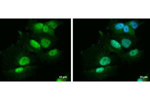 ICC/IF Image PBX1 antibody [N2C3] detects PBX1 protein at nucleus and cytoplasm by immunofluorescent analysis. (PBX1 抗体  (Center))