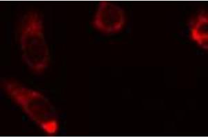 ABIN6274454 staining HuvEc cells by IF/ICC. (AKAP1 抗体  (Internal Region))