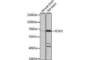 Western blot analysis of extracts of various cell lines, using KCNJ3 antibody (ABIN6134057, ABIN6142731, ABIN6142733 and ABIN6225132) at 1:1000 dilution. (KCNJ3 抗体  (AA 50-150))