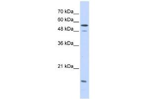 Karyopherin Alpha 2 antibody used at 1 ug/ml to detect target protein. (KPNA2 抗体)