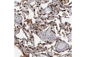 Immunohistochemical staining of human lung with SLC34A2 polyclonal antibody  shows strong cytoplasmic positivity in alveolar cells at 1:200-1:500 dilution.