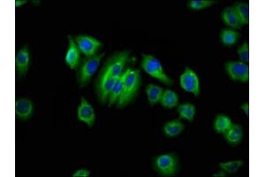 Immunofluorescence staining of A549 cells with ABIN7144503 at 1:66, counter-stained with DAPI. (Aquaporin 1 抗体  (AA 209-301))
