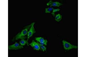 Immunofluorescent analysis of Hela cells using ABIN7158341 at dilution of 1:100 and Alexa Fluor 488-congugated AffiniPure Goat Anti-Rabbit IgG(H+L) (LIMS1 抗体  (AA 1-325))