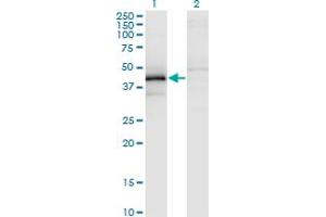 Western Blot analysis of ZFYVE19 expression in transfected 293T cell line by ZFYVE19 monoclonal antibody (M02), clone 3G4-2B11. (ZFYVE19 抗体  (AA 1-396))