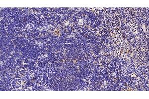 Immunohistochemistry (IHC) image for anti-Sirtuin 3 (SIRT3) (AA 127-303) antibody (ABIN7435925)