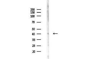 anti-Arrestin Domain Containing 2 (ARRDC2) (C-Term) antibody