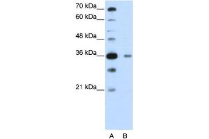 WB Suggested Anti-DAZAP1  Antibody Titration: 0. (DAZAP1 抗体  (C-Term))