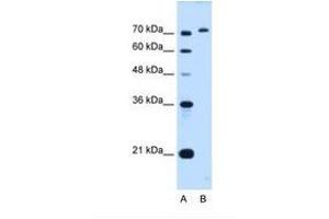 Image no. 1 for anti-GPI Anchor Attachment Protein 1 (GPAA1) (C-Term) antibody (ABIN6738244) (GPAA1 抗体  (C-Term))