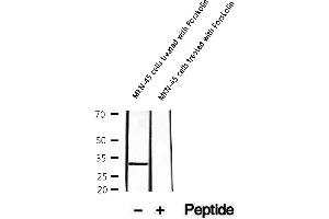 Western blot analysis of extracts of MKN-45 cells treated with Forskolin, using Phospho-DARPP-32 (Ser97) Antibody .