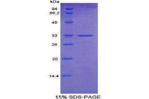 SDS-PAGE analysis of Mouse Cytochrome P450 24A1 Protein. (CYP24A1 蛋白)
