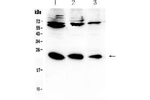 Western blot analysis of IL-2 using anti-IL-2 antibody . (IL-2 抗体  (AA 21-153))