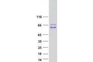 Validation with Western Blot