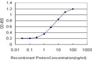 Detection limit for recombinant GST tagged GRK4 is approximately 0. (GRK4 抗体  (AA 36-145))
