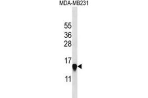 Western Blotting (WB) image for anti-Histone Cluster 2, H2aa3 (HIST2H2AA3) antibody (ABIN2997480) (HIST2H2AA3 抗体)