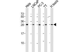 All lanes : Anti-SSX1 Antibody (Center) at 1:2000 dilution Lane 1: Hela whole cell lysate Lane 2: LNCaP whole cell lysate Lane 3: PC-3 whole cell lysate Lane 4: TT whole cell lysate Lane 5: human testis lysate Lysates/proteins at 20 μg per lane. (SSX1 抗体  (AA 97-128))