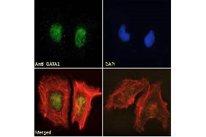 Immunofluorescence (IF) image for anti-GATA Binding Protein 1 (Globin Transcription Factor 1) (GATA1) (Internal Region) antibody (ABIN185449)