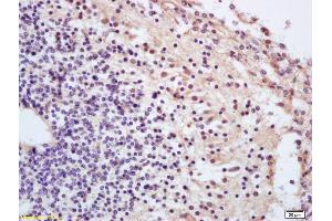 Formalin-fixed and paraffin embedded mouse embryo labeled with Anti-Phospho-cdc25A (Thr506) Polyclonal Antibody, Unconjugated (ABIN684028) at 1:200 followed by conjugation to the secondary antibody and DAB staining (CDC25A 抗体  (pThr507))