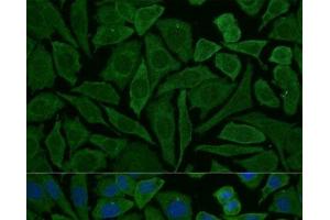 Immunofluorescence analysis of L929 cells using NDUFB2 Polyclonal Antibody at dilution of 1:100 (40x lens). (NDUFB2 抗体)