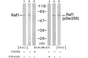 Image no. 2 for anti-V-Raf-1 Murine Leukemia Viral Oncogene Homolog 1 (RAF1) (pSer259) antibody (ABIN196618) (RAF1 抗体  (pSer259))
