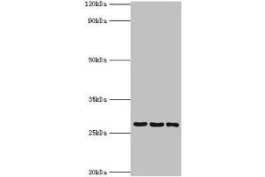 Western blot All lanes: 14-3-3 protein theta antibody at 4 μg/mL Lane 1: A549 whole cell lysate Lane 2: Mouse lung tissue Lane 3: HepG2 whole cell lysate Secondary Goat polyclonal to rabbit IgG at 1/10000 dilution Predicted band size: 28 kDa Observed band size: 28 kDa