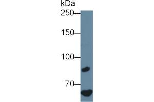Detection of F8 in Human Hela cell lysate using Polyclonal Antibody to Coagulation Factor VIII (F8)