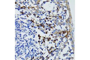 Immunohistochemistry of paraffin-embedded human tonsil using USO1 antibody (ABIN5971479) at dilution of 1/100 (40x lens). (USO1 抗体)