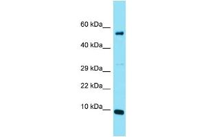 Host: Rabbit Target Name: C20orf166 Sample Type: Jurkat Whole Cell lysates Antibody Dilution: 1. (C20orf166 抗体  (N-Term))